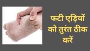 अब नहीं फटेगी एड़ियां,नारियल तेल और एलोवेरा को इस प्रकार करें इस्तेमाल,सभी पुछेंगे राज