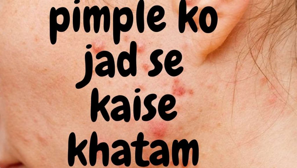 pimple ko jad se kaise khatam kare जानिए चेहरे पर क्यों आते हैं