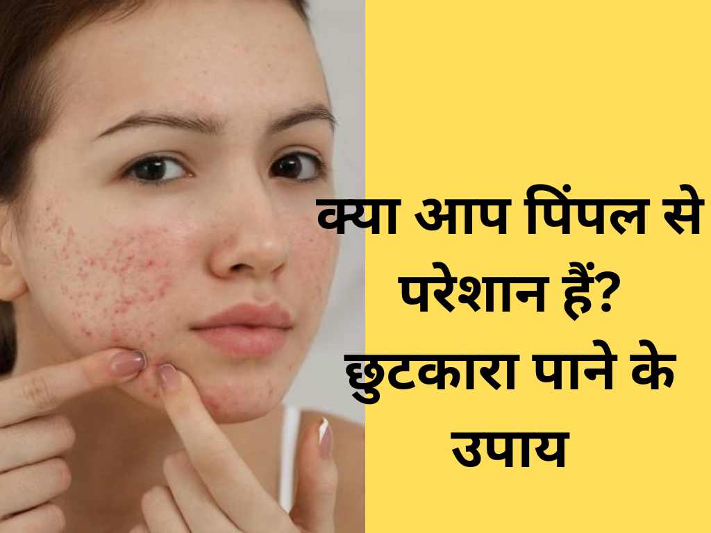 pimple ko jad se kaise khatam kare