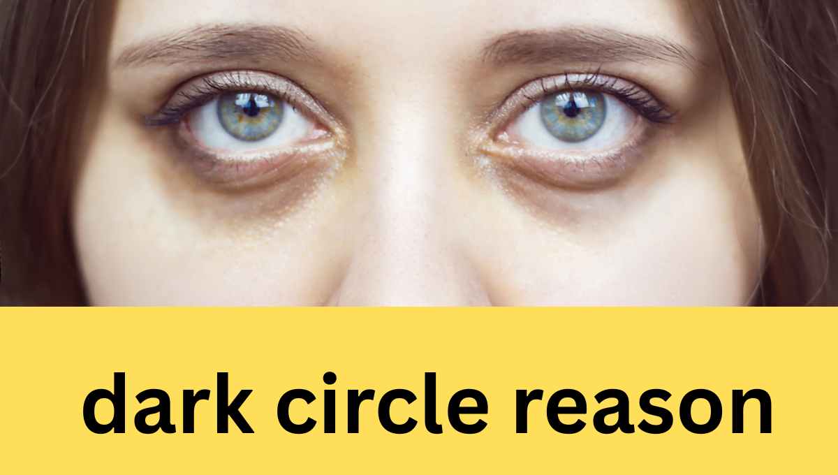 dark circle reason