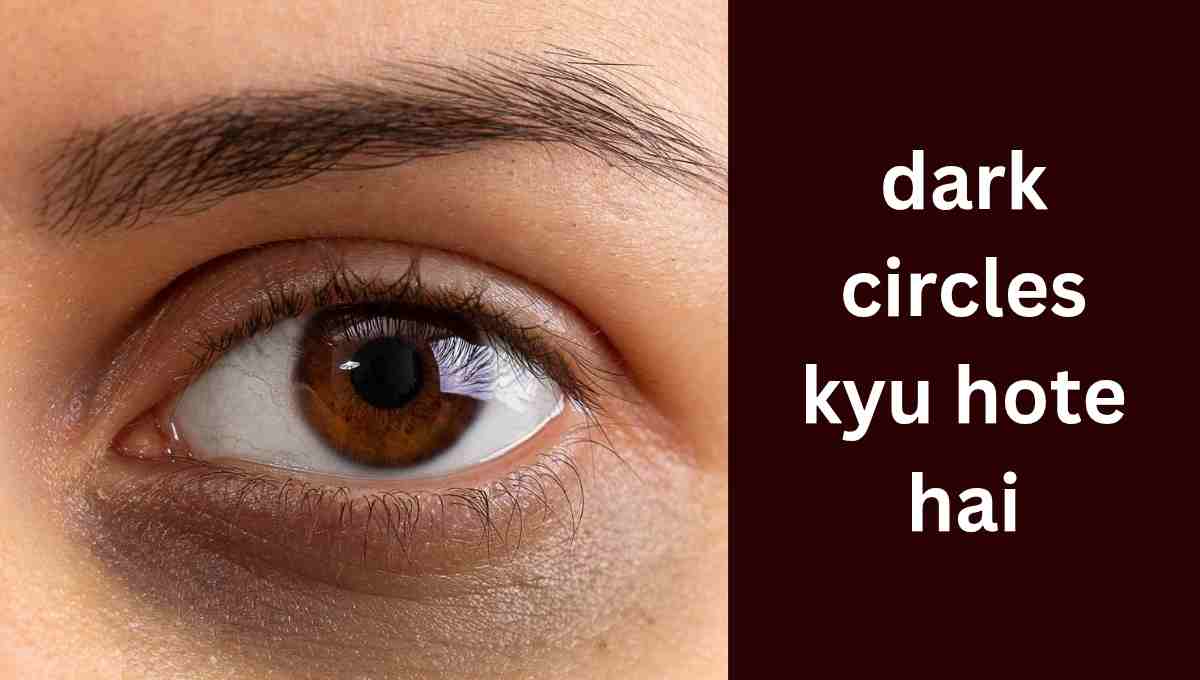 aankhon ke niche dark circle kyon hote hain